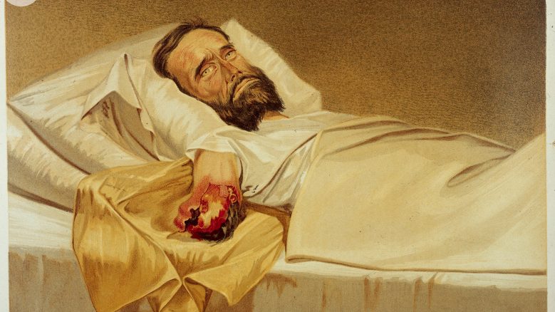 Artwork of man lying in bed with an amputated arm.